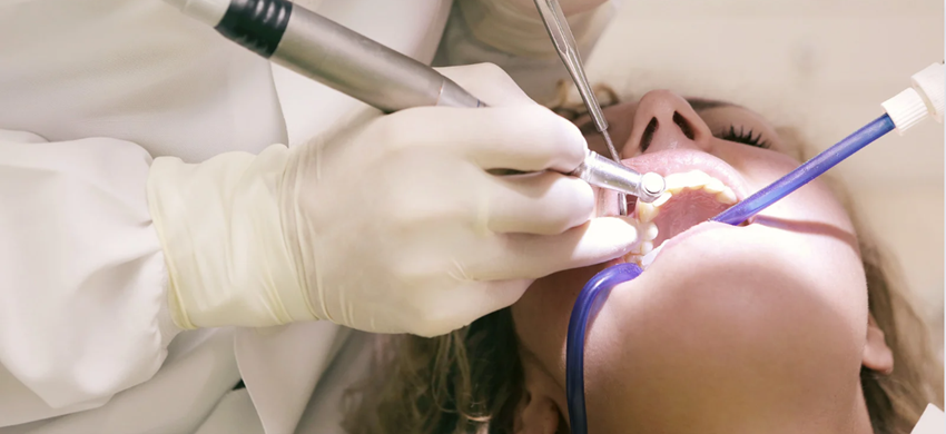 10.メンテナンスとフォローアップ：歯科医師との定期的な診察