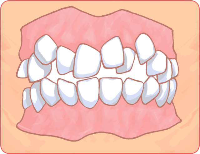 矯正歯科