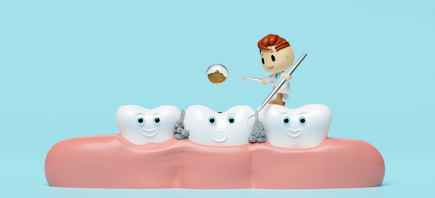 2.歯周病の主な原因：プラークとその他のリスク要素