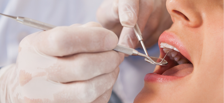 3. 歯周病の兆候：見逃されがちな初期症状