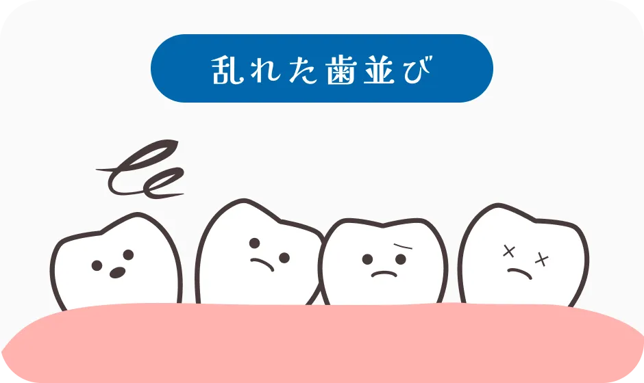 乱れた歯並び